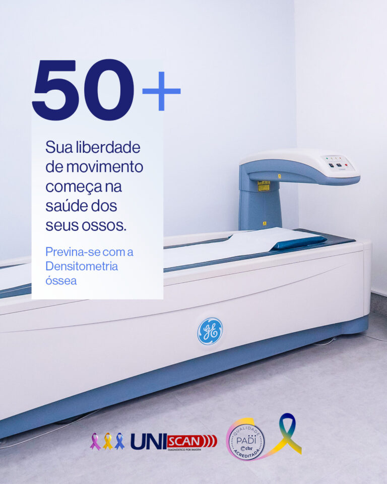 SEUS OSSOS